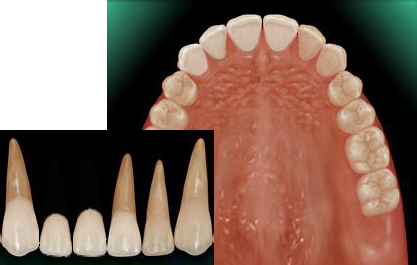 �O���u���b�W�i�I�[���Z���~�b�N�j