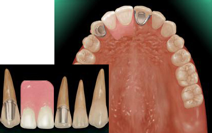 �O���`���i�R�[�k�X�j