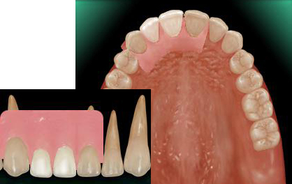 �O���`���i�m���N���X�v�j