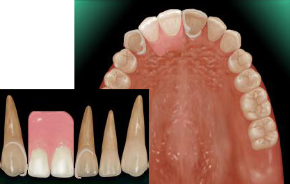 �O���`���i�z���C�g�N���X�v�j