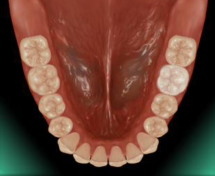 �W���R�j�A�Z���~�b�N�N���E��