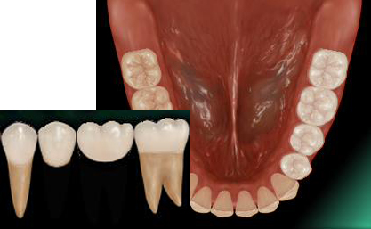 �P���u���b�W�i�I�[���Z���~�b�N�j