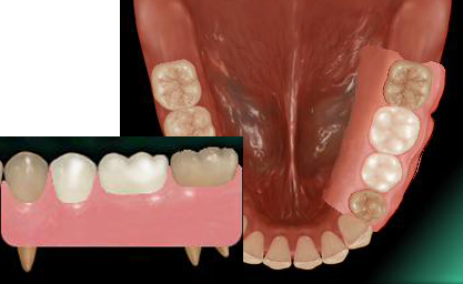 �P���`���i�m���N���X�v�j